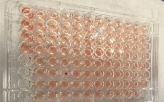 比“熊猫血”罕见百倍！广东顺德发现一例“钻石血” !