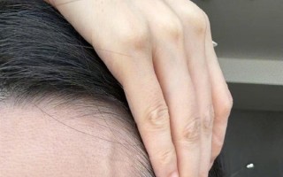 张靓颖自曝体检查出营养不良：额头血管莫名突起 伸懒腰手掌就流血 !