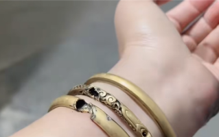 女子给电动车充电大金镯子被电碎：手上肉也被烧黑 !